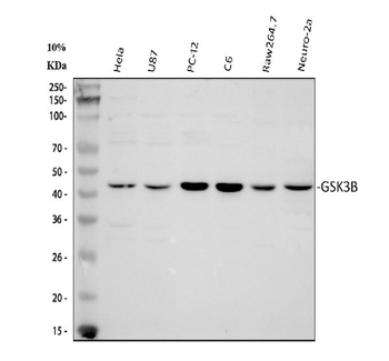 Anti-GSK3 beta/GSK3B Antibody
