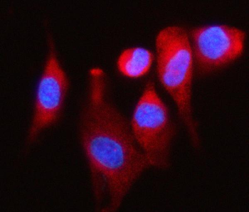 Anti-P97/DAP5/EIF4G2 Antibody