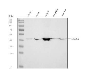 Anti-YKL-40/CHI3L1 Antibody