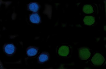 Anti-CENPF Antibody