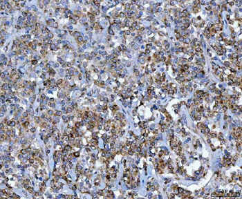 Anti-CAD Antibody