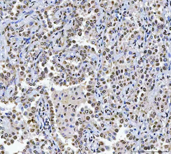 Anti-CAD Antibody