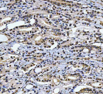Anti-CAD Antibody