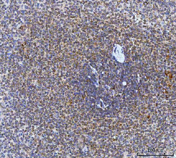 Anti-CAD Antibody