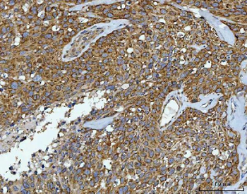 Anti-CAD Antibody