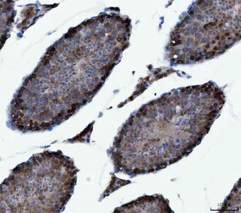 Anti-CAD Antibody