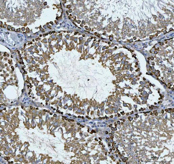Anti-CAD Antibody