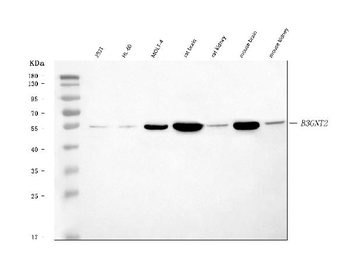 Anti-B3GNT2 Antibody