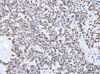 Anti-Aurora A/AURKA Antibody