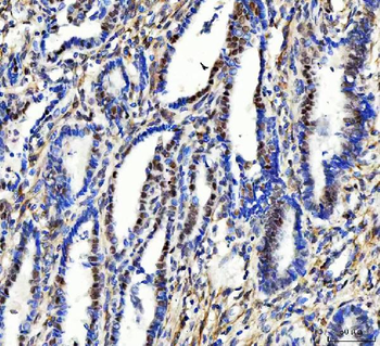 Anti-Aurora A/AURKA Antibody