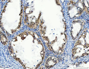 Anti-Aurora A/AURKA Antibody