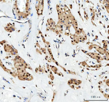 Anti-Aurora A/AURKA Antibody