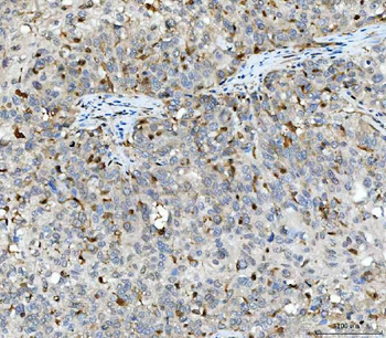 Anti-Aurora A/AURKA Antibody