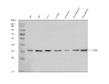 Anti-AIDA Antibody