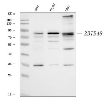 Anti-ZBTB48 Antibody