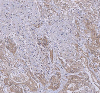 Anti-WDR44 Antibody