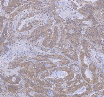 Anti-WDR44 Antibody