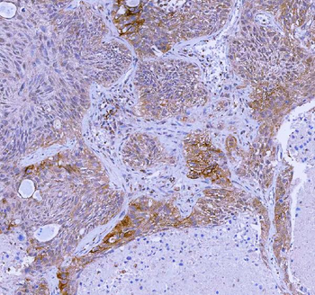 Anti-WDR44 Antibody