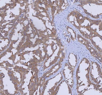 Anti-WDR44 Antibody