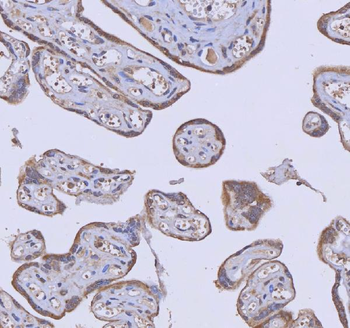 Anti-WDR44 Antibody
