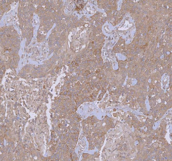 Anti-WDR44 Antibody