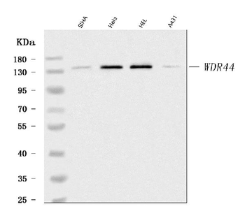 Anti-WDR44 Antibody