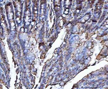 Anti-VAPA Antibody