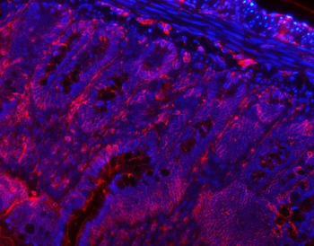 Anti-VAPA Antibody