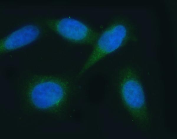 Anti-VAPA Antibody