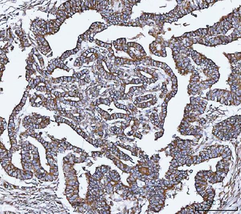 Anti-VAPA Antibody
