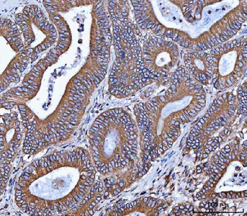 Anti-VAPA Antibody