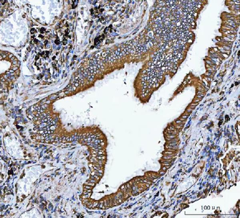 Anti-VAPA Antibody