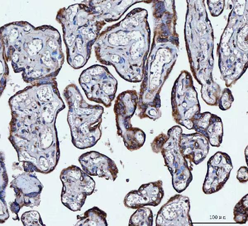 Anti-VAPA Antibody