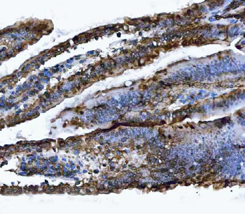 Anti-VAPA Antibody