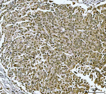 Anti-TWIST1/2 Antibody