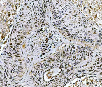 Anti-TWIST1/2 Antibody