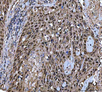 Anti-TWIST1/2 Antibody