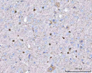Anti-TWIST1/2 Antibody