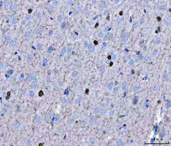 Anti-TWIST1/2 Antibody