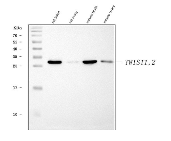 Anti-TWIST1/2 Antibody