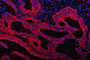 Anti-TRMT61B Antibody