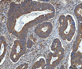 Anti-TRMT61B Antibody
