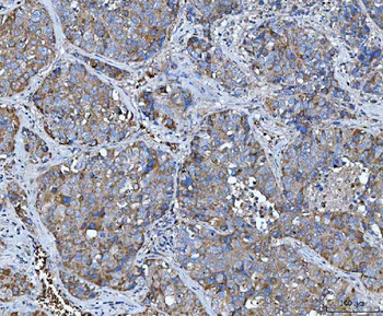Anti-TRMT61B Antibody
