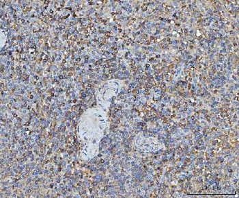 Anti-TRMT61B Antibody