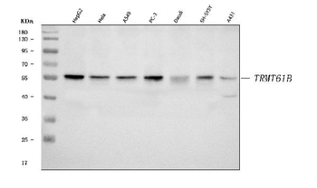 Anti-TRMT61B Antibody