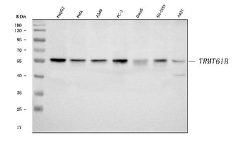 TRMT61B Antibody