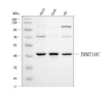 Anti-TRMT10C Antibody