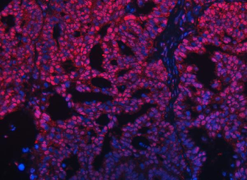 Anti-TRMT10C Antibody