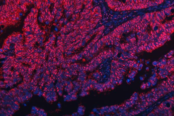 Anti-TRMT10C Antibody
