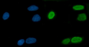 Anti-TRMT10C Antibody
